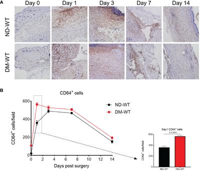 CD64 plays a key role in diabetic wound healing